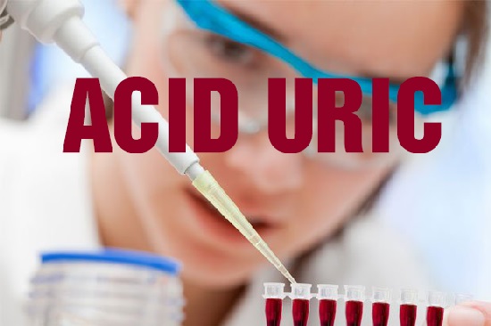 Giảm acid uric - yếu tố sống còn trong điều trị bệnh gout