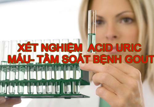 Xét nghiệm acid uric - Kiểm tra sức khỏe định kỳ giúp phát hiện sớm bệnh gout 