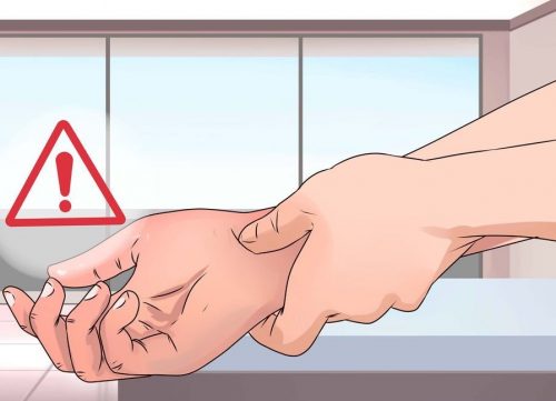 Đau cổ tay - Triệu chứng bệnh gout bạn cần quan tâm